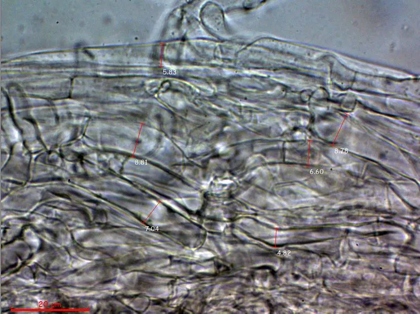 Microscopía de Pleurotus djamor - 10 - Medidas hifas suprapellis
